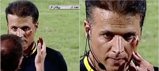 زخمی شدن کمک داور در آبادان+عکس 