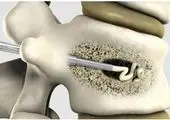 علت تغییر آمار شهدای حادثه تروریستی کرمان