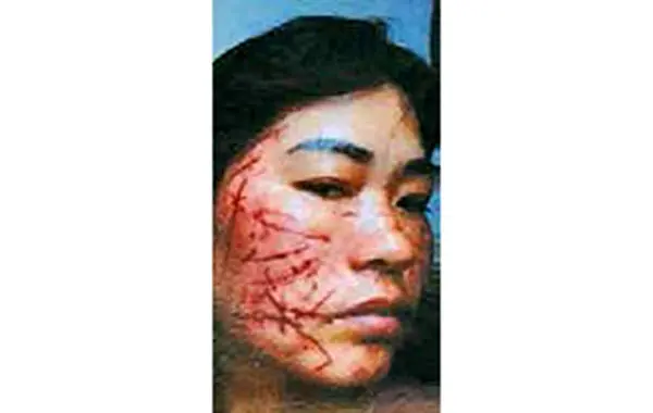 کتک خوردن وحشیانه زن جوان از شوهر و هوویش+عکس