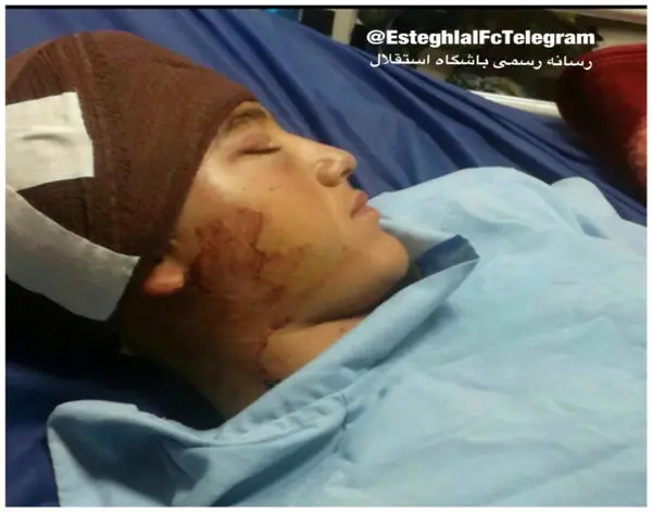 واکنش باشگاه استقلال به مصدومیت یک هوادار در اهواز