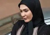 چهره جدید و تغییریافته خانم بازیگر+عکس
