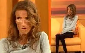 رژیم غذایی دختر جوان را به کام مرگ برد + تصاویر