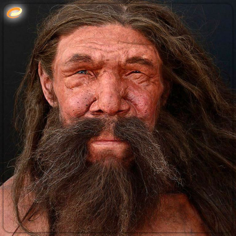 
10 میهمانان ناخوانده ترسناک روی بدن انسان +عکس
