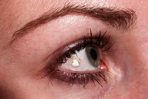 روستایی که مردمانش کور هستند!+عکس 