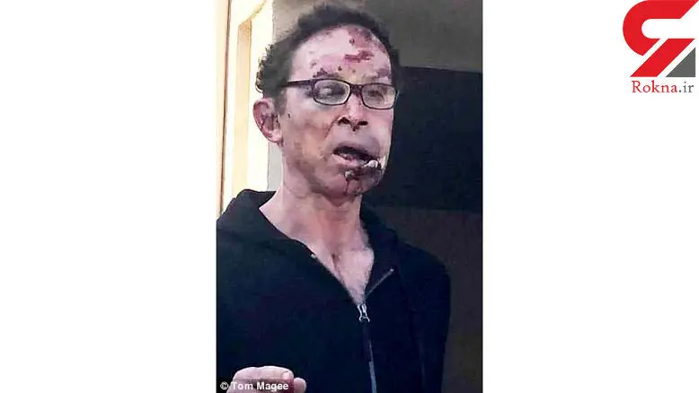  2 پسر جوان فک قوی ترین مرد جهان را شکستند + عکس 