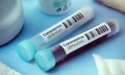 کیت ایرانی تشخیص سریع کرونا رونمایی شد