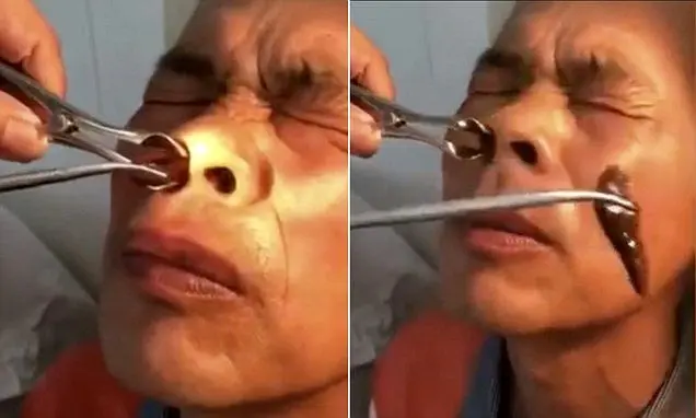 
صحنه ای عجیب که یک پزشک با آن روبرو شد + عکس
