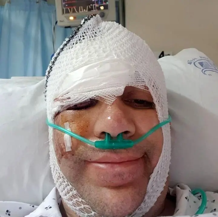 تصادف شدید کمدین معروف خندوانه با اتوبوس + تصاویر