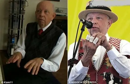 پیانو نوازی پیرمرد هنرمند با انگشتان قطع شده!+عکس