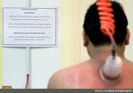 حجامت برای
همه
افراد مفید نیست