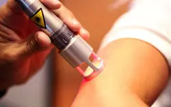 آنچه که باید درباره انواع لیزر پوست بدانید