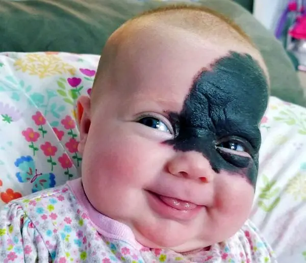 جای بوسه شیطان در چهره نوزاد دختر + عکس