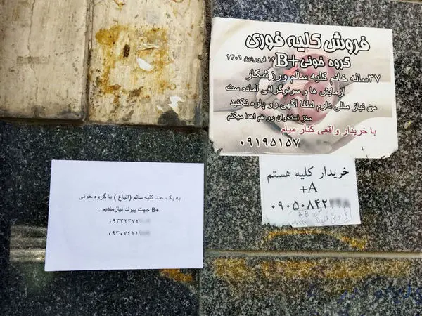 اسکناس هایی که بوی خون می‌دهد/ فروش اعضای بدن کسب و کار جدید فقرای آبرومند!