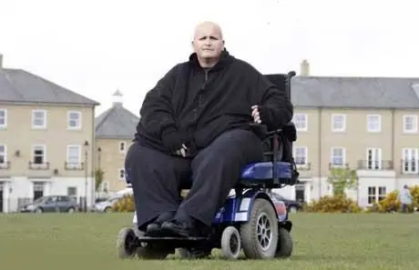 لاغرشدن بسیار عجیب یک مرد 200 کیلویی! +عکس