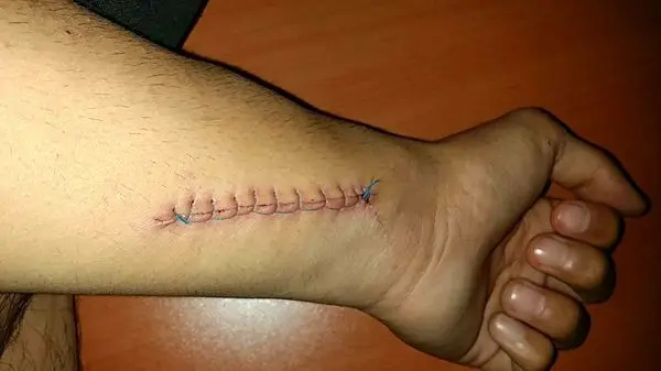 حمله به ۲ طلبه نیشابوری با چاقو +عکس