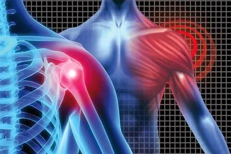 بیماری های ناشی از بحران اقتصادی