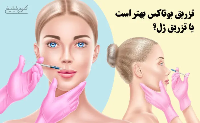 تزریق بوتاکس بهتر است یا تزریق ژل؟