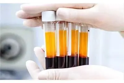 اهدا کنندگان پلاسمای خون در وزارت کار تشویق می شوند
