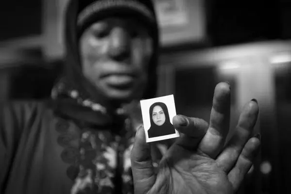 قربانیان اسیدپاشی چطور با زندگی جدید تا میکنند؟