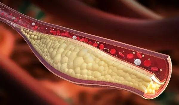 مقابله با چربی خون با این غذای مفید!