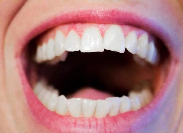 
۳ توصیه برای پیشگیری از بوی بد دهان
