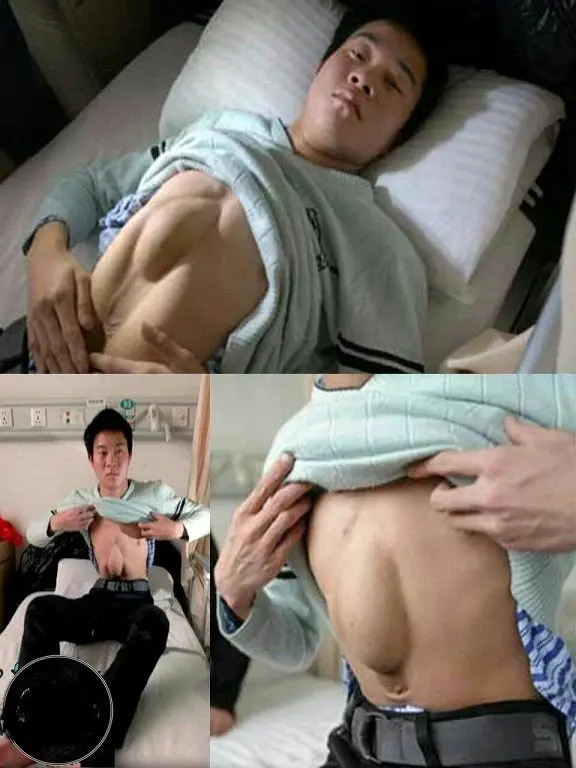 مردی که قلبش در شکمش قرار دارد+عکس