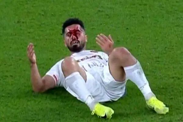 آخرین وضعیت مصدومیت امید عالیشاه