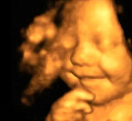 خوشحال ترین بچه جهان به دنیا آمد! +عکس