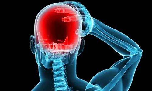 اگر این نشانه‌ها را دارید سکته مغزی در کمین شماست!
