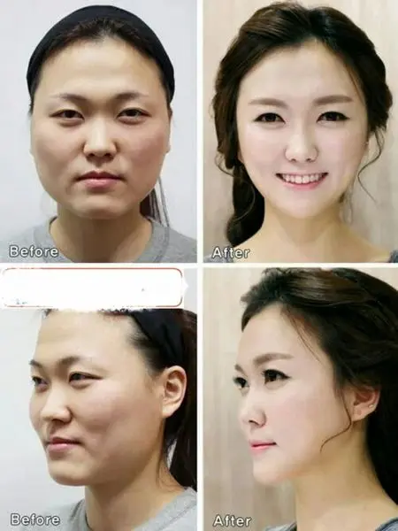 نمونه باورنکردنی یک عمل جراحی در صورت+عکس