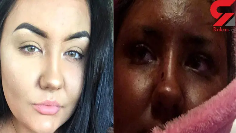 رنگ سبز بدن بخاطر حس زیبایی ! + عکس 