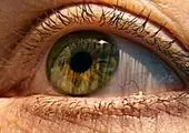 ترسناک‌ترین عمل‌های جراحی برای زیبایی در جهان + تصاویر
