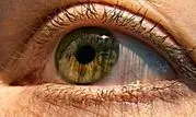 خارج کردن کرم زنده از چشمان یک انسان+عکس