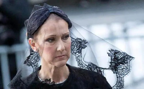 چهره اولیه خانم سلبریتی قبل از عمل زیبایی+عکس