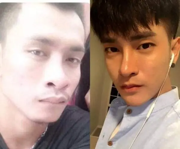 30 عمل جراحی برای شبیه شدن به کره ای ها ! + عکس