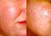 عمل های جراحی عجیب یک پسر برای شبیه شدن به دیوید بکهام+عکس