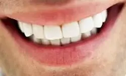 20 موردی که لبخندتان را زشت می کند!